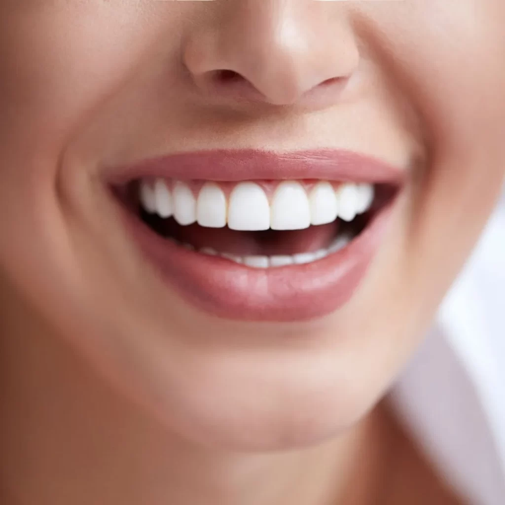 Woman showcasing her bright smile after receiving the best teeth whitening treatment