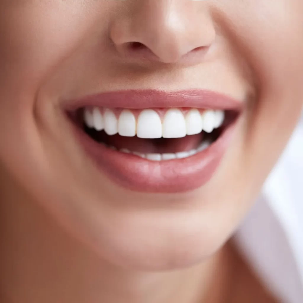 Woman after best teeth whitening service