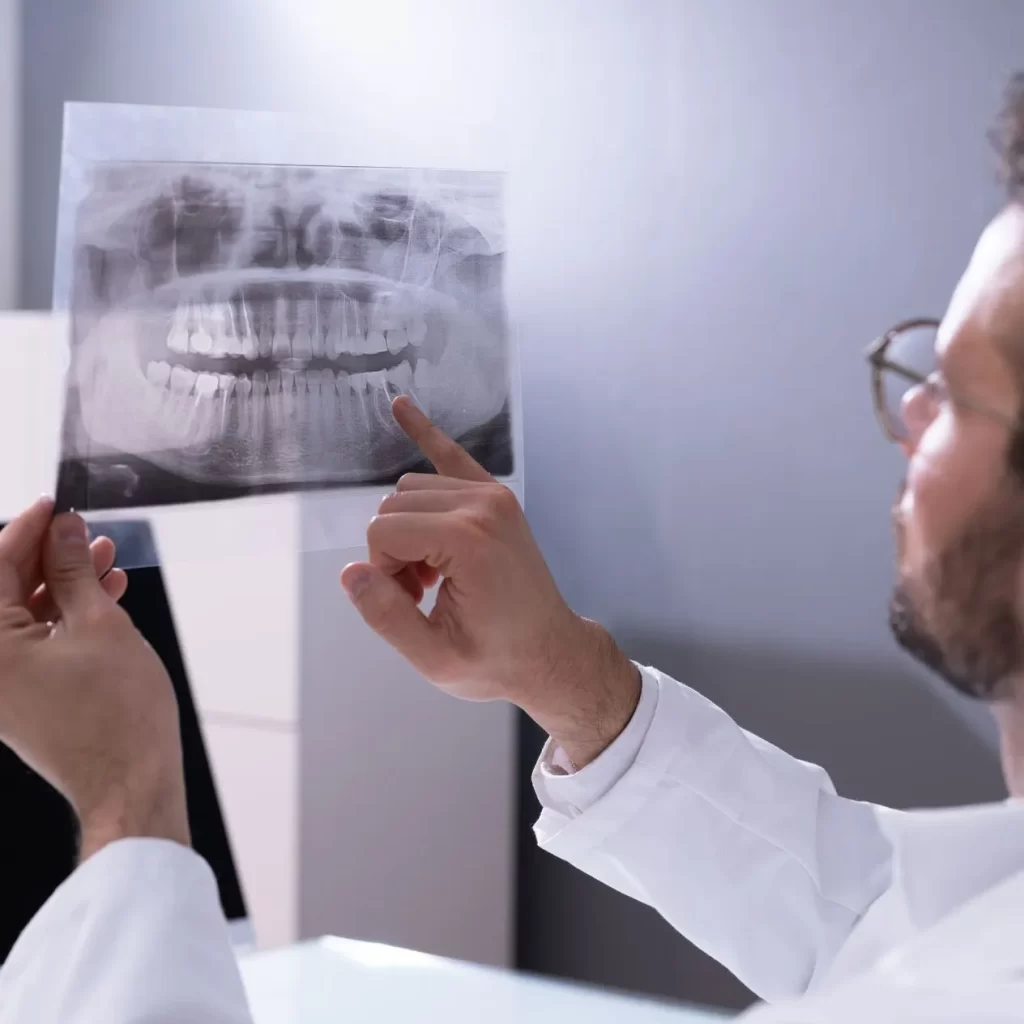 Dentist preparing for wisdom teeth removal surgery