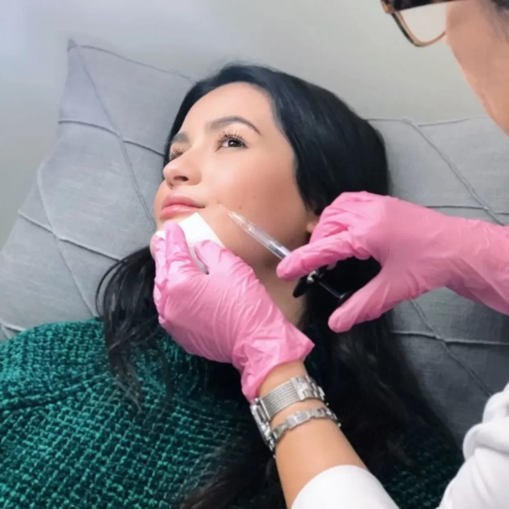 nurse injecting dermal fillers into the cheek