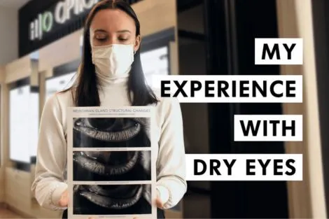 lady holding dry eyes photo after diagnosis