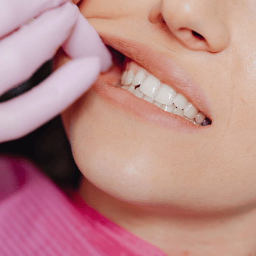Patient at a dentist checking What+Is+Chipped+Tooth+Repair_+_
